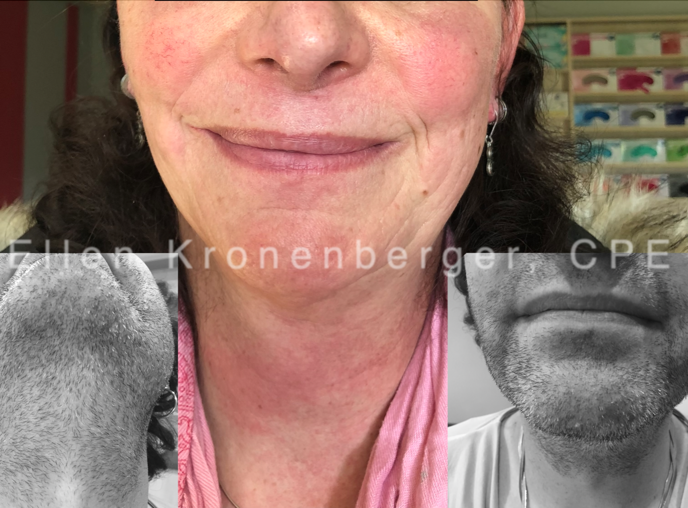 Zwischen der Ausgangssituation im Februar 2017 (Bilder: rechts und links) und dem finalen Ergebnis im November 2019 (Bild: Mitte) liegen 73 Behandlungsstunden